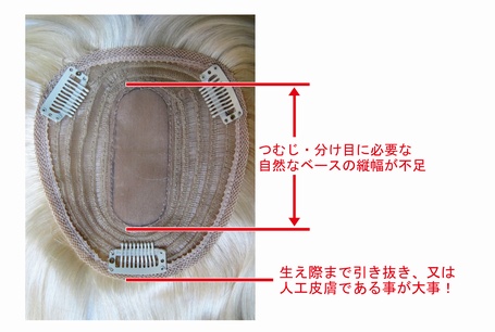 ヘアピースの内側