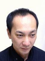男性かつらモデル画像ビフォー
