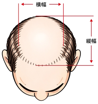 男性のウィッグサイズを測るイラスト